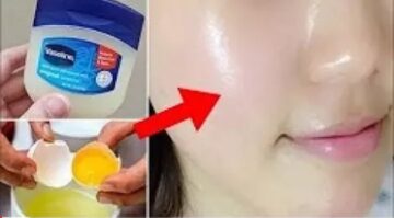 هتلمعي مثل النجوم.. دهنة واحدة من الفازلين علي بشرتك هتشوفي بعينك بياض ثلجي في لحظات