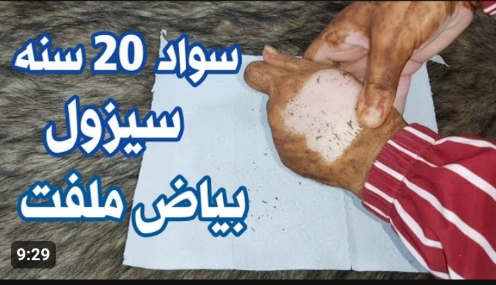« مش هتروحى بعد كده لاي كوافير » .. طريقة تقشير البشرة في المنزل .. هتبقى جميلة جداً 5 « مش هتروحى بعد كده لاي كوافير » .. طريقة تقشير البشرة في المنزل .. هتبقى جميلة جداً