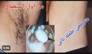 « وشك وجسمك مش هتلاقى فى شعره » .. حطى معلقة واحدة من الفازلين كل يوم بهذه الطريقة وشوفى النتيجة
