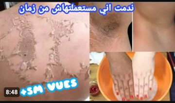 حطي كريم الفازلين والقرنفل المبهر على بشترك يعمل على تبييض الوجه