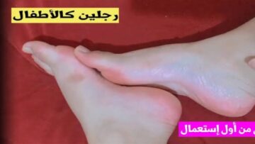 كعوبك هتبقى زي الفراولة.. مكون سحري هيقشر رجلك ويريحك من التشققات كلها في 15 دقيقة
