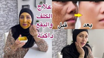 hq72زؤزسظس0 3 1 1