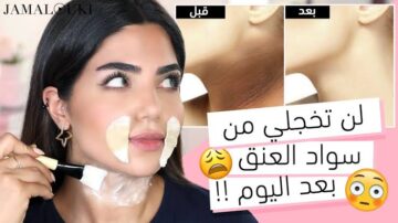 مضمونة النتيجة.. إليك أكثر الوصفات فاعلية للتخلص من اسمرار الوجه والرقبة في مدة قياسية بمكونات آمنة على بشرتك