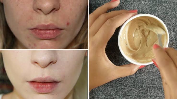 بمكونات من مطبخك .. إليك أسهل طريقة لعمل كريم الأساس لمختلف ألوان البشرة آمن وصحي على بشرتك.. جربيه وهتدعيلي 5 بمكونات من مطبخك .. إليك أسهل طريقة لعمل كريم الأساس لمختلف ألوان البشرة آمن وصحي على بشرتك.. جربيه وهتدعيلي