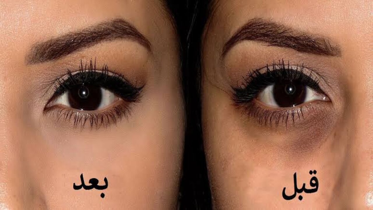 ندمت اني مش معرفهاش.. بكيس خميرة صغير هتتخلصي من الهالات السوداء نهائيا في 5 دقائق 5 ندمت اني مش معرفهاش.. بكيس خميرة صغير هتتخلصي من الهالات السوداء نهائيا في 5 دقائق