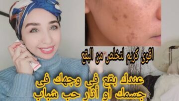 لبشرة لامعة مثل النجوم.. ماسك طبيعي للتخلص من جميع مشاكل البشرة بنتائج خيالية
