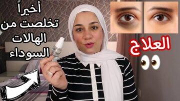 خلي وشك يرجع ينور.. طريقة سحرية للتخلص من الهالات السوداء خلال 3 أيام