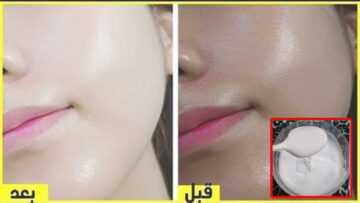 دلكي بدلكة النشا جسمك كله وتخلصي من سواد وتصبغات السنين وتمتعي بجسم أبيض قشطة وناعم