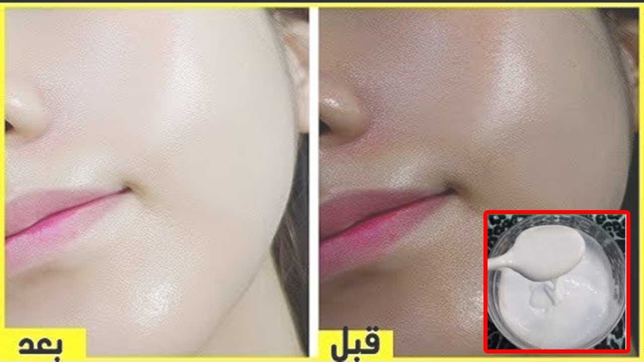 بياض ملفت بالنشا والزبادي تبييض وتفتيح للبشرة وإزالة سواد السنين 5 بياض ملفت بالنشا والزبادي تبييض وتفتيح للبشرة وإزالة سواد السنين
