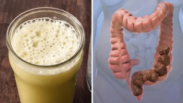 كنز لا يقدر بثمن.. مشروب تنظيف القولون السحرى ستخرج منك فضلات السنين كالاحجار والتخلص من الامساك والسموم.. النتيجة مبهرة