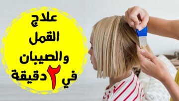 مكون ضعيه على شعرك هيختفي القمل والصيبان فوراً من اول استخدام ولن يعود مجددا خاصة لدى الأطفال