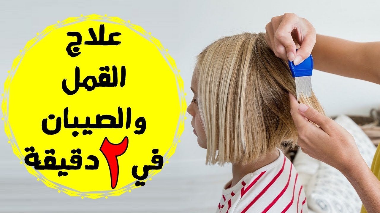 مكون ضعيه على شعرك هيختفي القمل والصيبان فوراً من اول استخدام ولن يعود مجددا خاصة لدى الأطفال 5 مكون ضعيه على شعرك هيختفي القمل والصيبان فوراً من اول استخدام ولن يعود مجددا خاصة لدى الأطفال