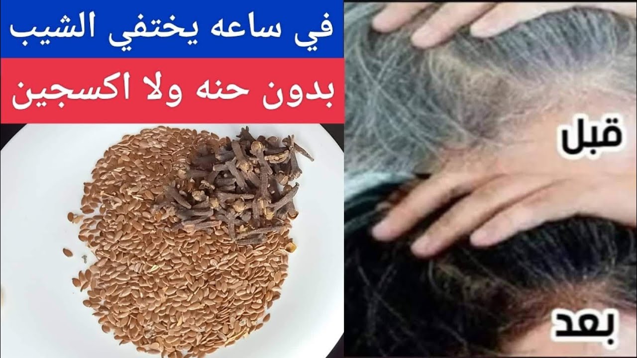 بدون صبغات.. معجزة القهوة والقرنفل للتخلص من شيب الشعر المبكر في ربع ساعة حتي لو كان شعرك كله أبيض 5 بدون صبغات.. معجزة القهوة والقرنفل للتخلص من شيب الشعر المبكر في ربع ساعة حتي لو كان شعرك كله أبيض