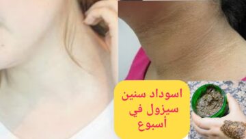 بياض الثلج.. بملعقة فازلين تخلصي من سواد المناطق الحساسة والاسمرار حتي لو فحمة من أول يوم هتبقي زي القشطة