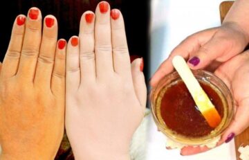 خلطة تبييض اليدين وإزالة الاسمرار والبقع