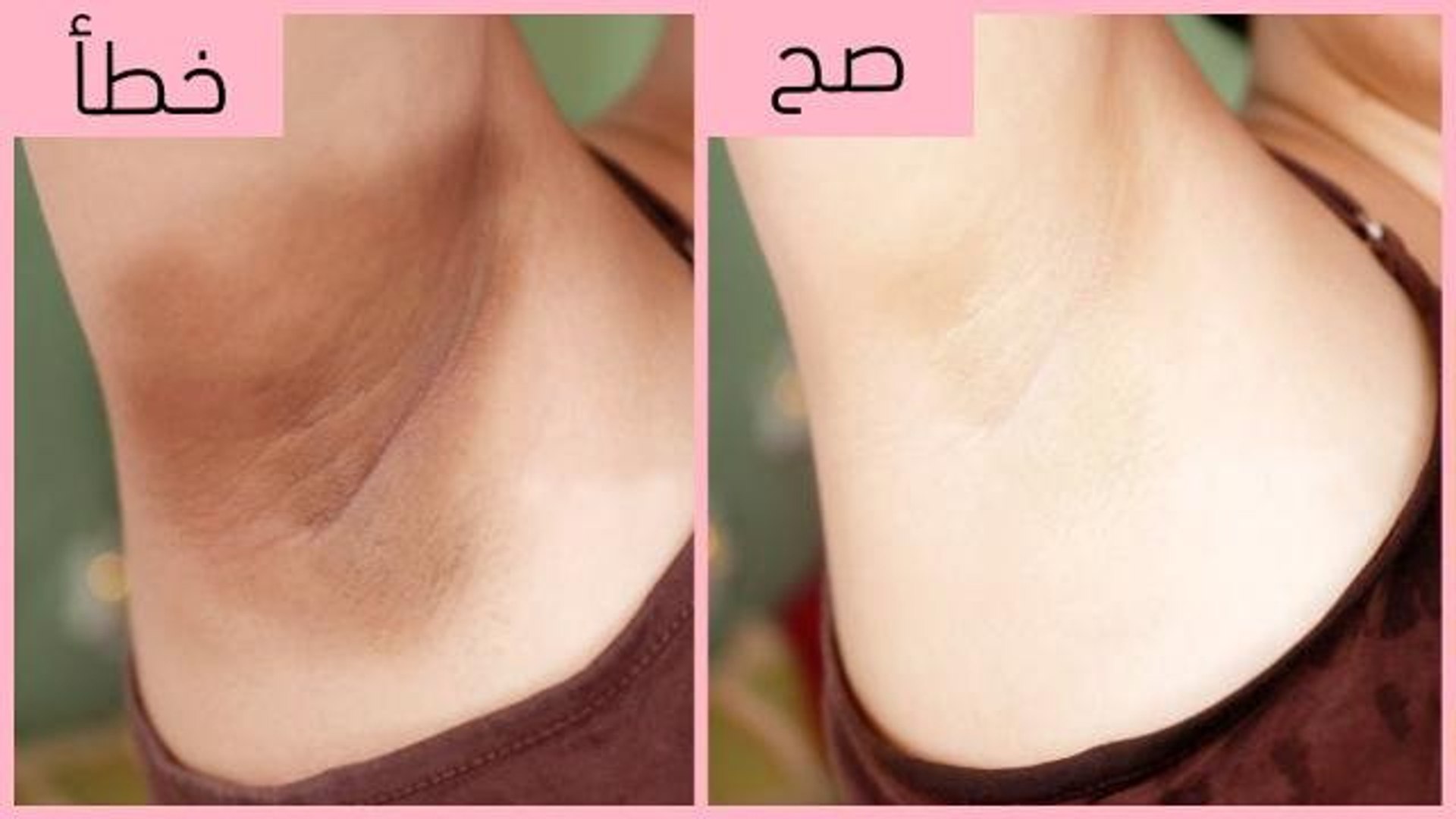 لو فرحك قرب أسرع خلطة تبييض الاماكن الحساسه وتحت الإبطين والقضاء على تصبغات وسواد السنين 5 لو فرحك قرب أسرع خلطة تبييض الاماكن الحساسه وتحت الإبطين والقضاء على تصبغات وسواد السنين