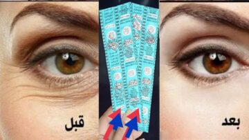 لن تحتاجي للبوتكس أو الفيلر بقرص أسبرين واحد تخلصي من التجاعيد واحصلي على بشرة مثالية