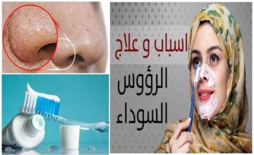 السر في معجون الأسنان للتخلص من الرؤوس السوداء.. وصفة جبارة 100% هتجيب من الاخر!