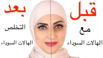 كيفية التخلص من الهالات السوداء بطرق سهلة وبسيطة