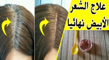 القرنفل لعلاج الشيب 1