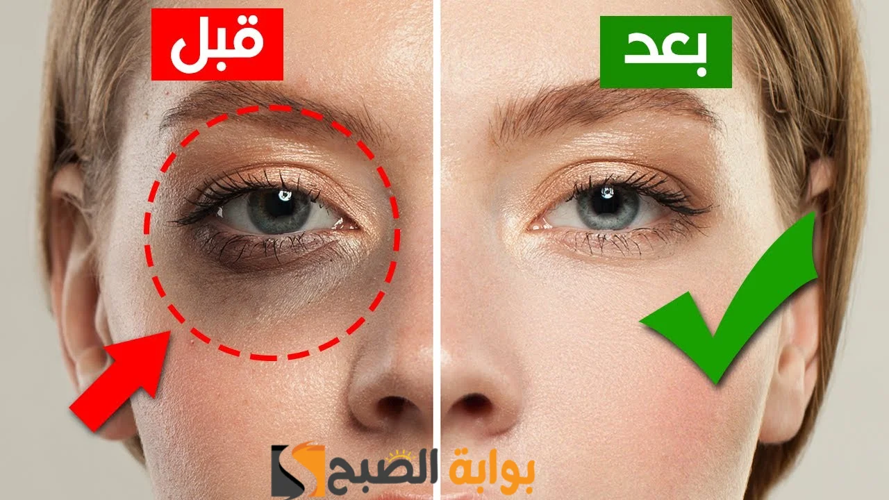 عيونك هتنور من تاني .. أفضل الوصفات الفعالة والمعالجة لإزالة الهالات السوداء حول العين "هتوفر لك فلوس الكونسيلر" 2 عيونك هتنور من تاني .. أفضل الوصفات الفعالة والمعالجة لإزالة الهالات السوداء حول العين “هتوفر لك فلوس الكونسيلر”