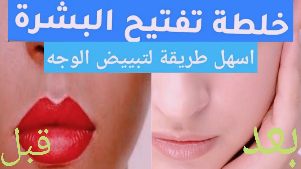 في أسبوع واحد فقط.. وصفة رهيبة ستبيض بشرتك بشكل ملحوظ بمكونات ستجديها عندك بالفعل 5 في أسبوع واحد فقط.. وصفة رهيبة ستبيض بشرتك بشكل ملحوظ بمكونات ستجديها عندك بالفعل