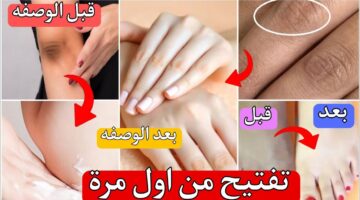 تبييض اليدين