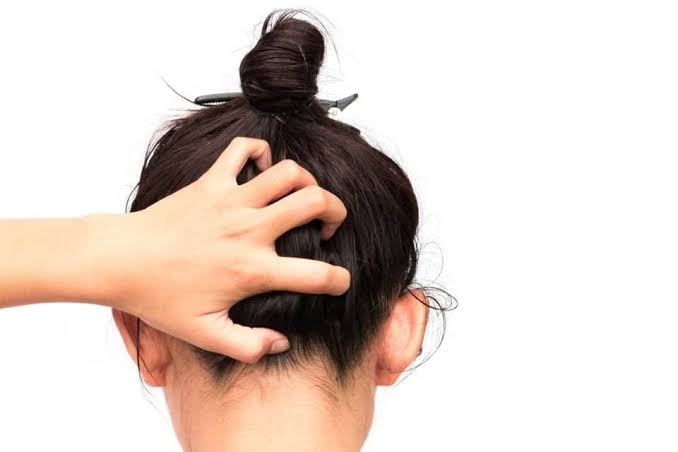 وصفة طبيعية لترطيب الشعر الهايش بسرعة في المنزل بمكونات متوفرة في كل بيت