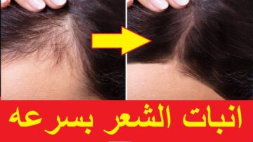 وصفة منزلية سريعة وفعالة لانبات فراغات الشعر ومقدمة الرأس بطريقة طبيعية ومجربة