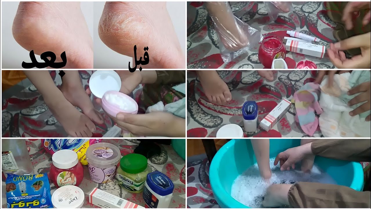 كعوبك هاتنور من أول مرة.. طريقة عمل باديكير في المنزل كأشهر صالونات التجميل 5 كعوبك هاتنور من أول مرة.. طريقة عمل باديكير في المنزل كأشهر صالونات التجميل