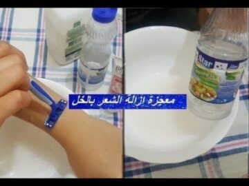فوائد الخل في إزالة الشعر لن يظهر مجددا بوصفة جديدة لن تتخيلها