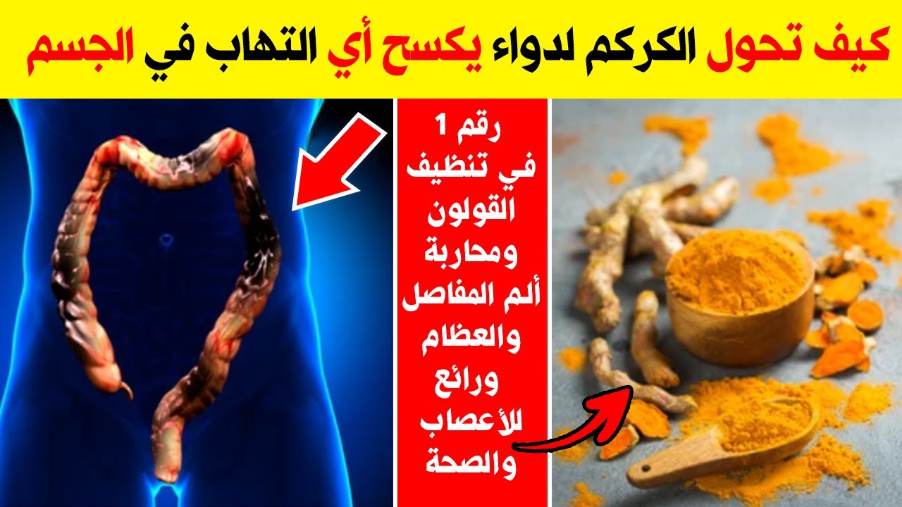 انسي مشاكل القولون والآم المفاصل نهائيا لو خدت الكركم كل يوم 5 انسي مشاكل القولون والآم المفاصل نهائيا لو خدت الكركم كل يوم