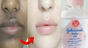 هدية للعرايس.. كريم زيت جونسون والنشا لتبييض الجسم الأسمر كله من البقع يزيل سواد 10سنين في ربع ساعة هتبقي بيضاء زي القشطة