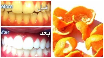 كيفية تحقيق ابتسامة أكثر بياضاً باستخدام قشور البرتقال لأسنان بيضاء كاللؤلؤء