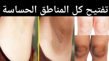 تفتيح المناطق الحساسة بدون ألم أو أضرار..خلطة مجربة لتفتيح المناطق الحساسة خلال 14 يوم