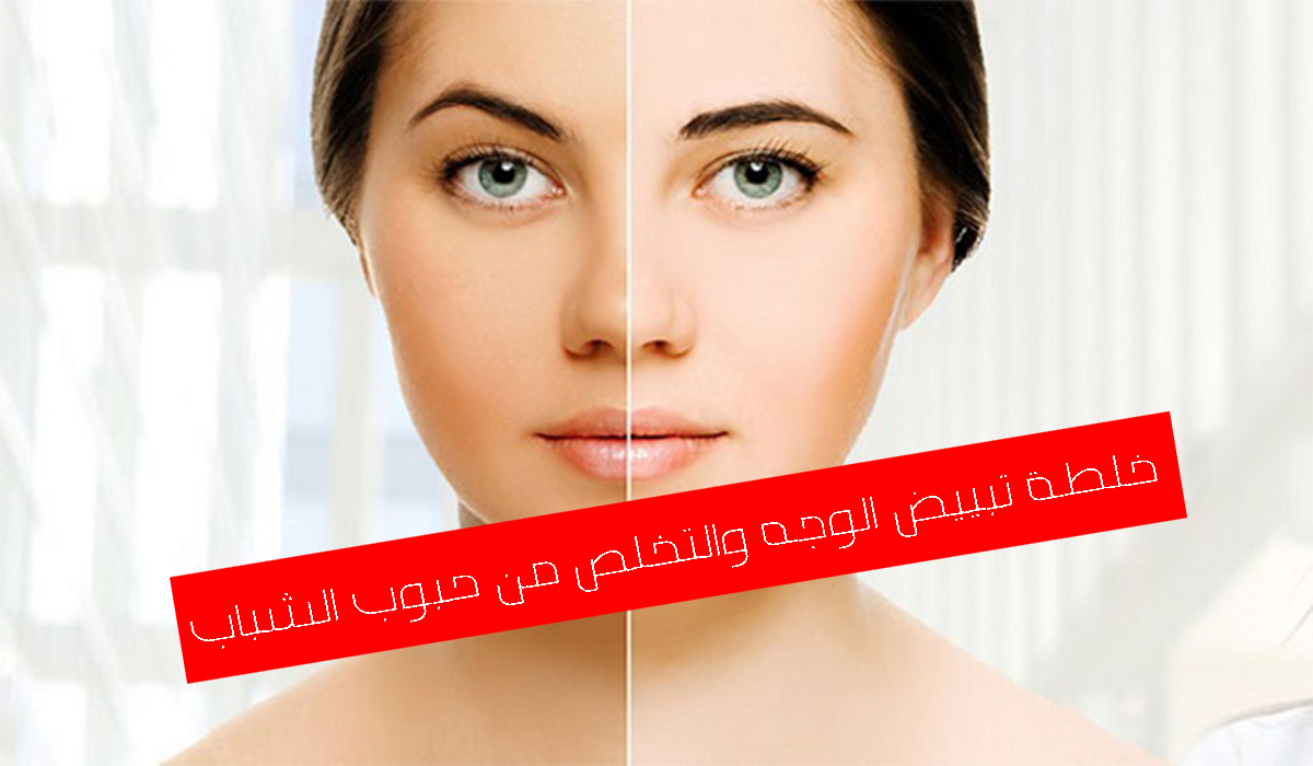 تعالي أقولك على وصفات تبييض وعلاج حب الشباب بالزبادي