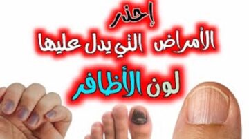 أحذر ظهور هذه الألوان على أظافرك فهي تنذر بوجود مشاكل صحية كبيرة