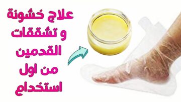 مقشر سحري لتشققات القدم وقولي وداعاً لجلسات صالون التجميل الباهظة