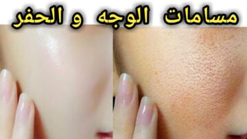 وصفات طبيعية للتخلص من مشكلة المسام الواسعة