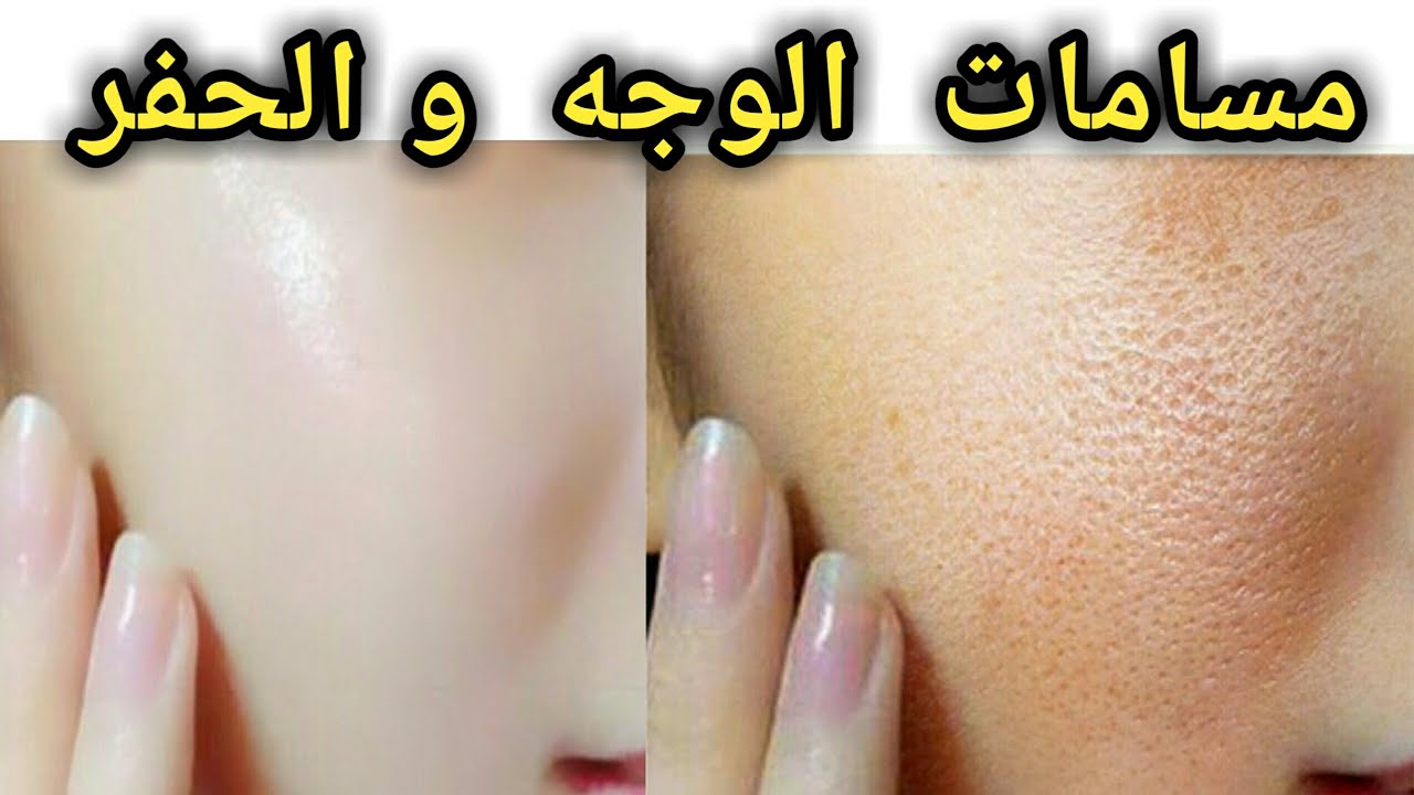 وصفات طبيعية للتخلص من مشكلة المسام الواسعة 5 وصفات طبيعية للتخلص من مشكلة المسام الواسعة