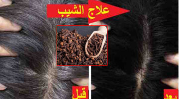 هاتي القرنفل وتعالي اقولك على طريقة التخلص من الشعر الأبيض