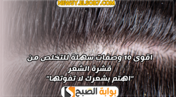 وصفات سهلة للتخلص من قشرة الشعر