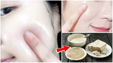 بمعلقة خميرة واحده وشك هينور وهتتخلصي من كل البقع الغامقة من اول مره