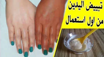 وصفة تبييض اليدين