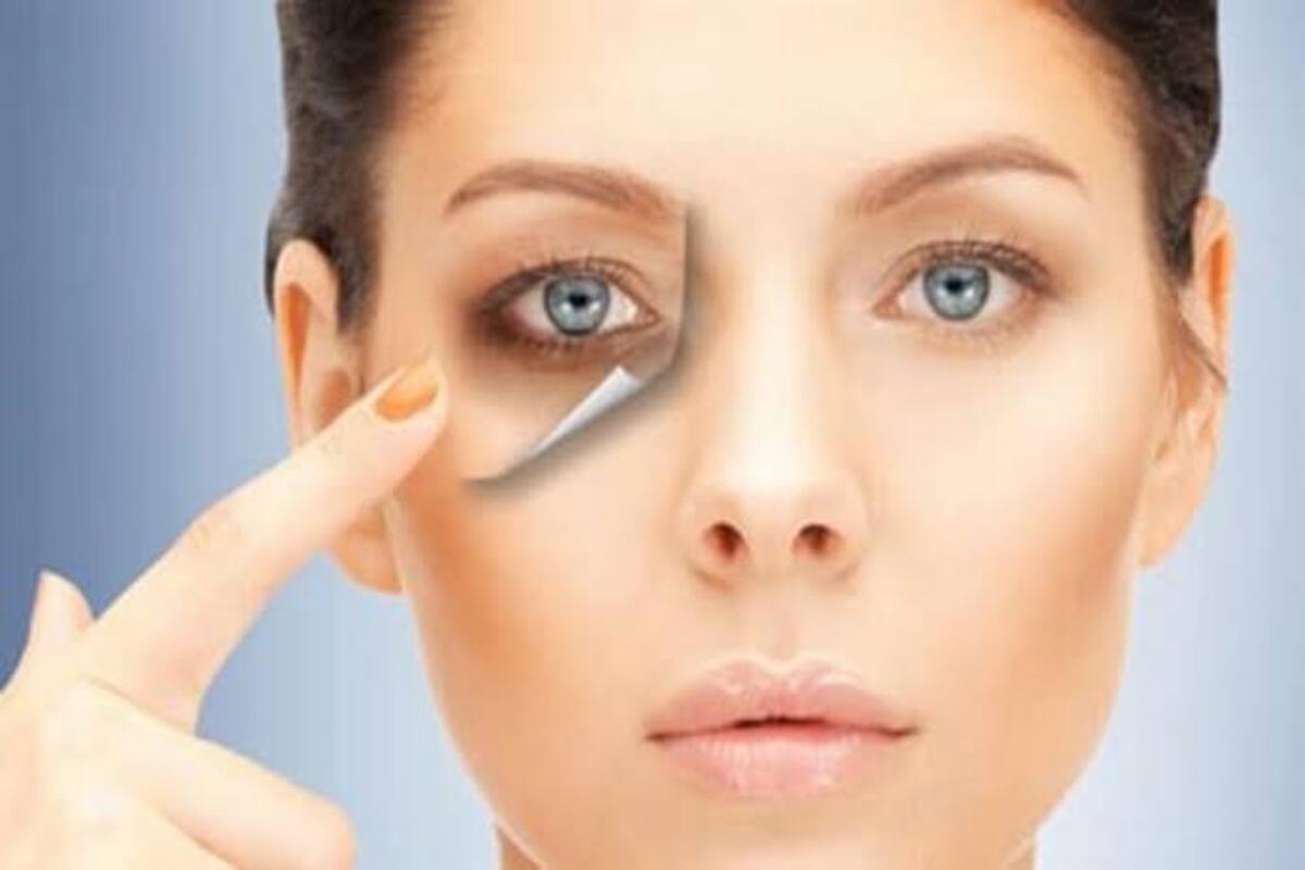 بمكونات منزلية .. تخلصي من الهالات السوداء بأسهل الطرق وبخطوات بسيطة 5 بمكونات منزلية .. تخلصي من الهالات السوداء بأسهل الطرق وبخطوات بسيطة