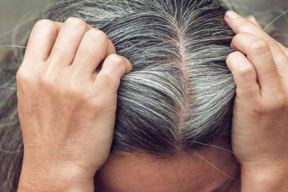 تخلصي من الشعر الأبيض … خلطات مجربة لصبغ شيب الشعر تغطية مثالية من أول مرة 5 تخلصي من الشعر الأبيض … خلطات مجربة لصبغ شيب الشعر تغطية مثالية من أول مرة