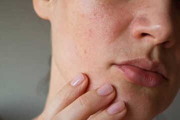 بأقل تكاليف ممكنة…5 ماسكات طبيعية لترطيب عميق للبشرة شتاءً
