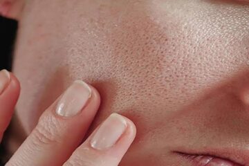 جل الصبار أكثرها فاعلية…علاج منزلي للتخلص من المسام الواسعة في البشرة
