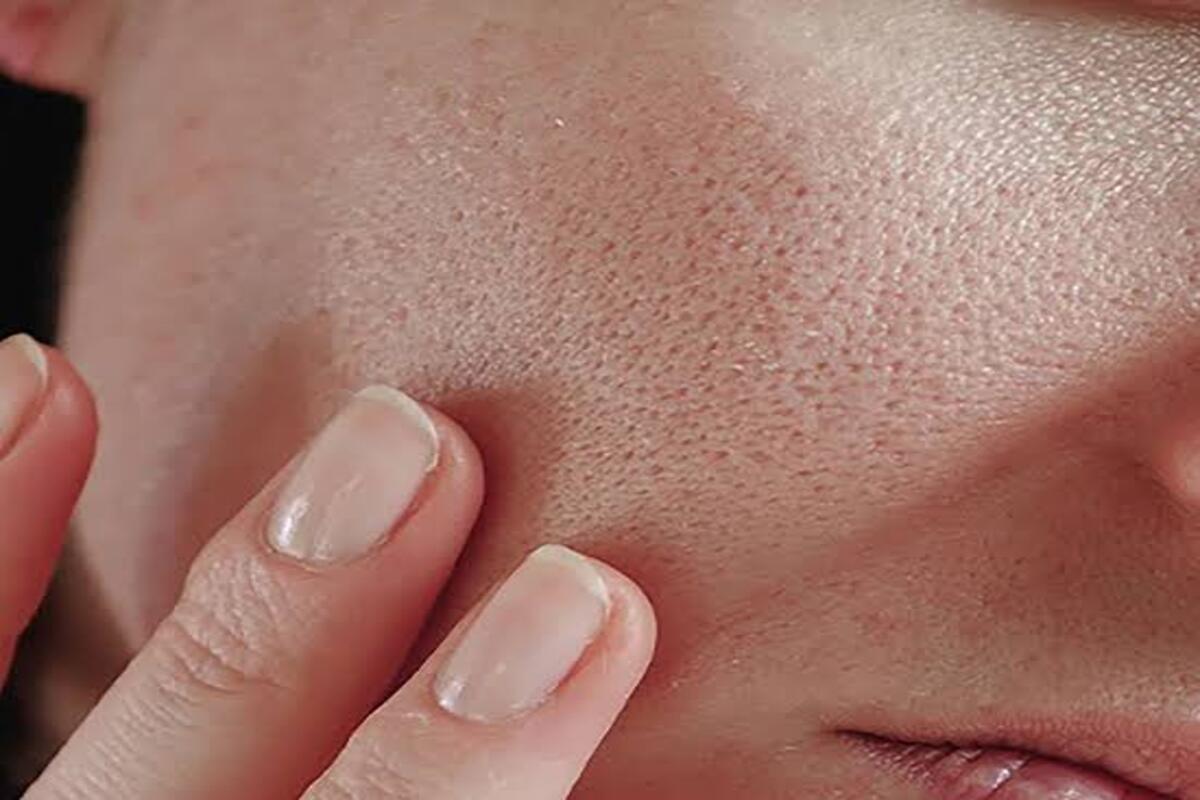 جل الصبار أكثرها فاعلية…علاج منزلي للتخلص من المسام الواسعة في البشرة 5 جل الصبار أكثرها فاعلية…علاج منزلي للتخلص من المسام الواسعة في البشرة