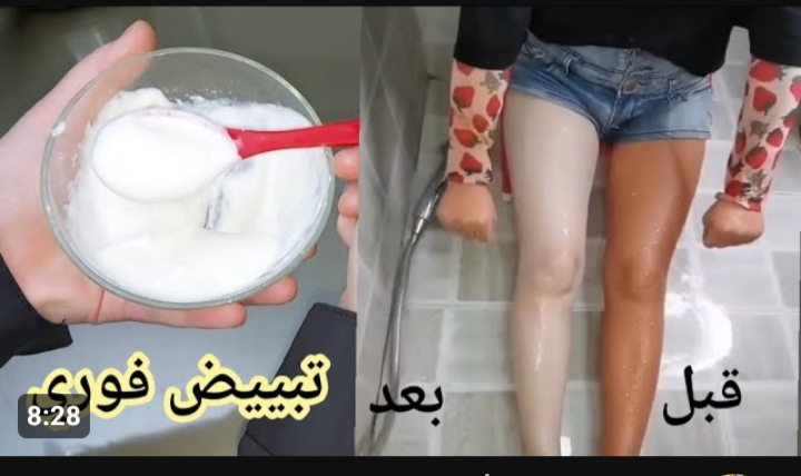 أرخص كريم من الصيدلية لتبييض العانة والإبطين والمناطق الحساسة في ربع ساعة حتي لو فحمة هتبقي بيضاء زي الحليب 5 أرخص كريم من الصيدلية لتبييض العانة والإبطين والمناطق الحساسة في ربع ساعة حتي لو فحمة هتبقي بيضاء زي الحليب